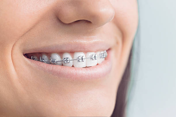 Best Traditional Braces  in Forest View, IL